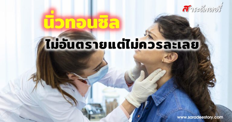 นิ่วทอนซิล ไม่อันตรายแต่ไม่ควรละเลย