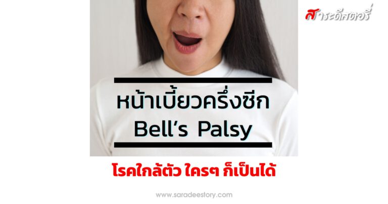 หน้าเบี้ยวครึ่งซีก (Bell’s Palsy ) โรคใกล้ตัว ใครๆ ก็เป็นได้ 