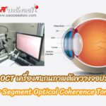 ชวนรู้จัก OCT เครื่องสแกนภาพตัดขวางจอประสาทตา
