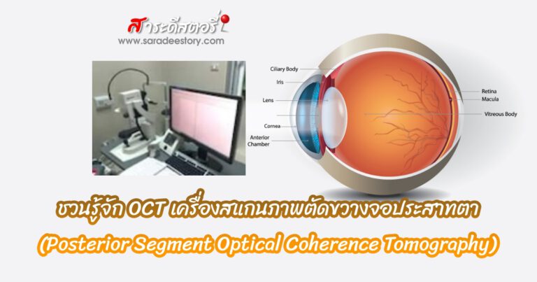 ชวนรู้จัก OCT เครื่องสแกนภาพตัดขวางจอประสาทตา