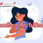 โรคน้ำเหลืองเสีย ไม่มีอยู่จริง
