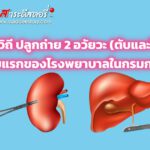 รพ.ราชวิถี ปลูกถ่าย 2 อวัยวะ (ตับและไต)สำเร็จเป็นรายแรกของโรงพยาบาลในกรมการแพทย์