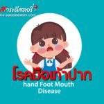 หมอยงชี้ โรคมือ เท้า ปาก ปีนี้จะมีแนวโน้มเพิ่มขึ้น