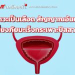 ปัสสาวะเป็นเลือด สัญญาณอันตราย เสี่ยงภัยมะเร็งกระเพาะปัสสาวะ