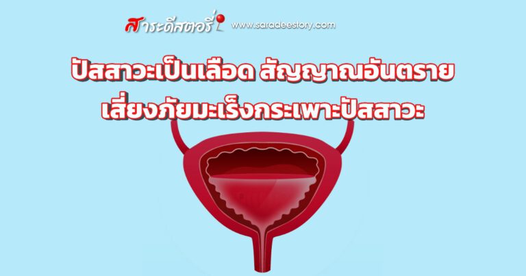 ปัสสาวะเป็นเลือด สัญญาณอันตราย เสี่ยงภัยมะเร็งกระเพาะปัสสาวะ