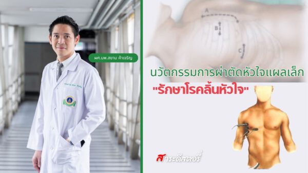 นวัตกรรมการผ่าตัดหัวใจแผลเล็ก "รักษาโรคลิ้นหัวใจ"